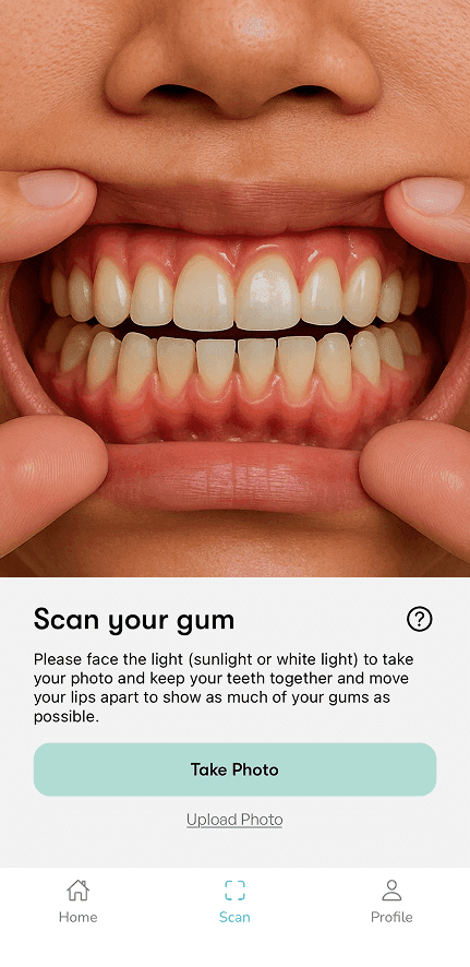 My Gum Health Mobile Application Scan Screen