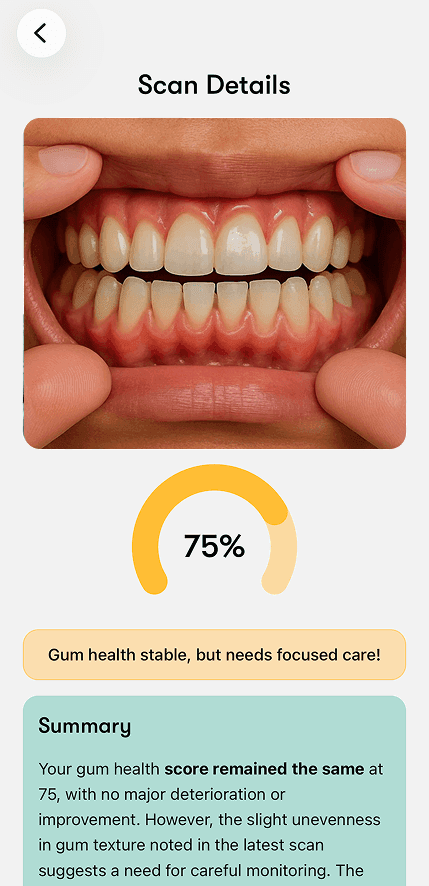 My Gum Health Mobile Application Result Screen